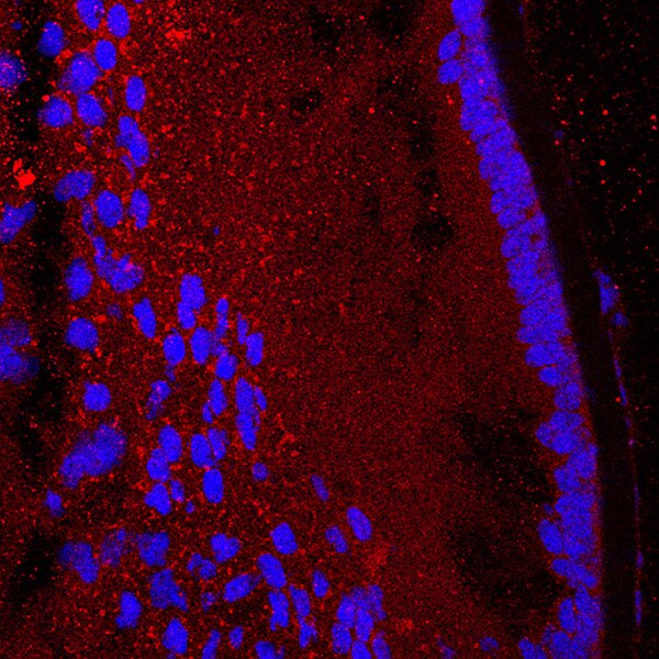 IF of a mouse lens labeled with DSHB antibody AFFN-KDM6B-7E10 against Lysine(K)-specific demethylase 6B (red). Image credit: Lachke Lab, University of Delaware.